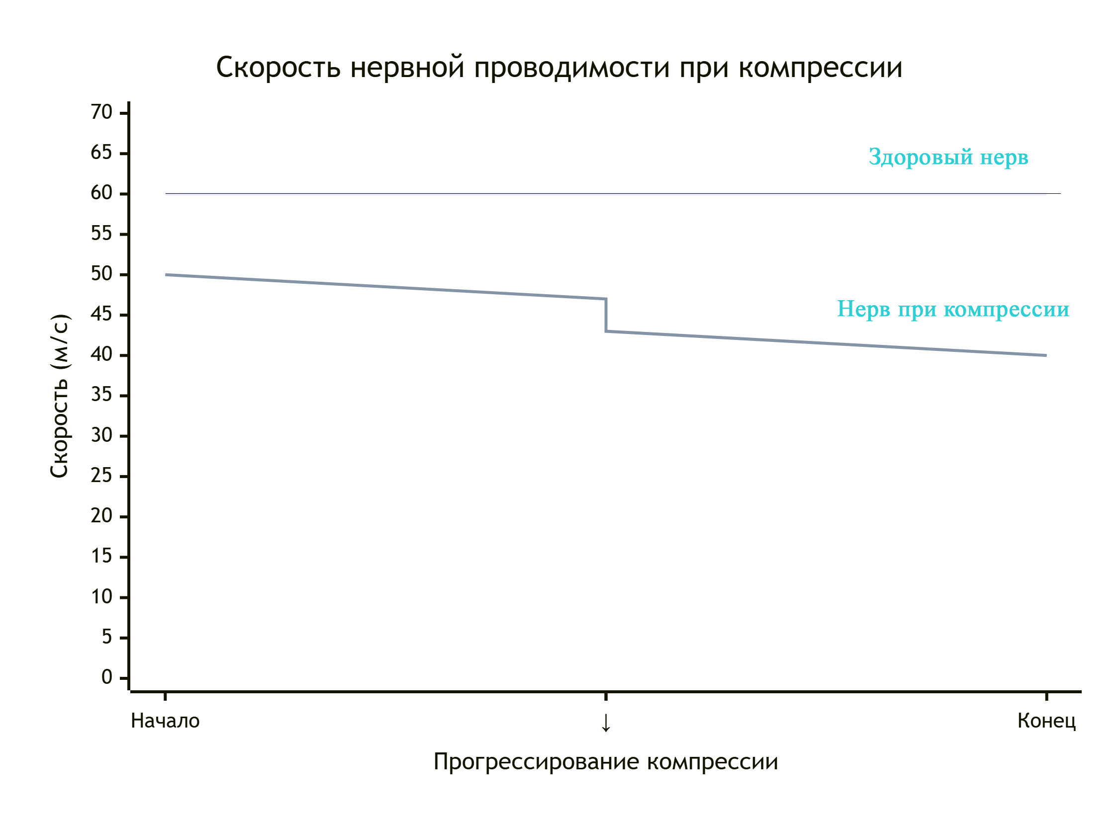 grafik neiropatii